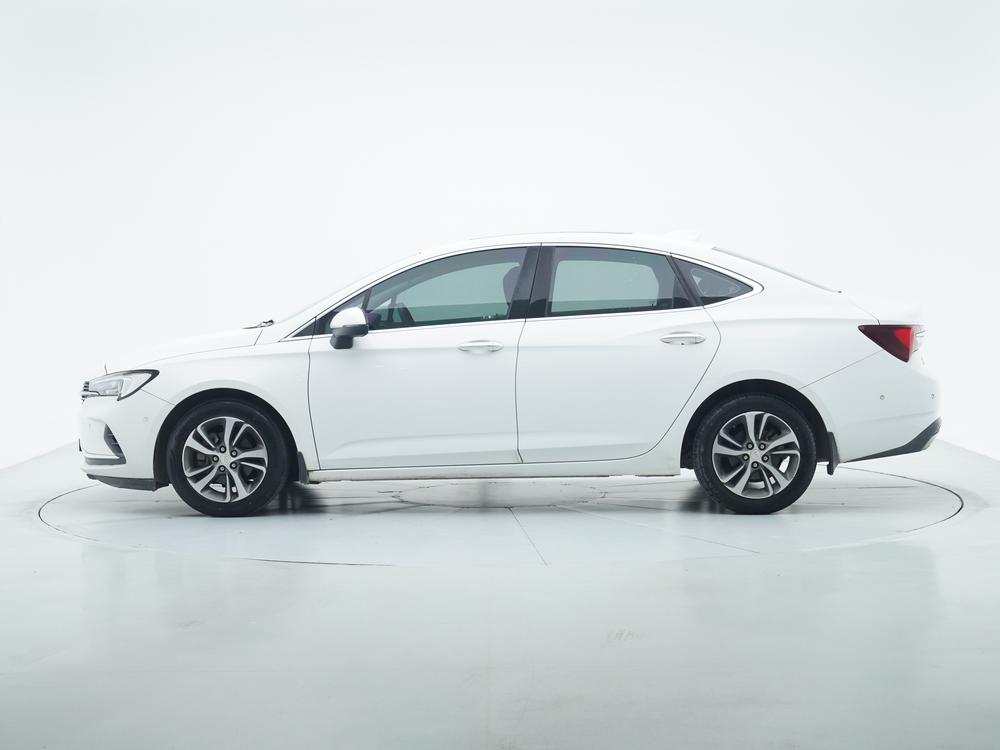 Buick Verano Модель 2020 года Тройная литиевая батарея кузов 20T CVT Luxury – фото 4